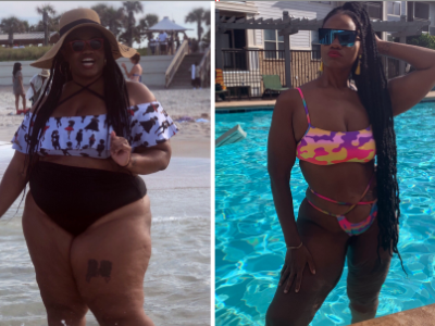 N-Hines-before-after